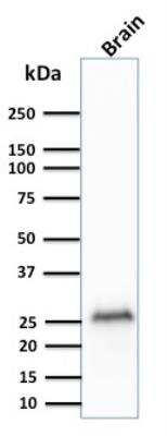 Western Blot: UCH-L1/PGP9.5 Antibody (rUCHL1/775) [NBP2-75773]
