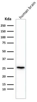 Western Blot: UCH-L1/PGP9.5 Antibody (rUCHL1/775) [NBP2-75773]