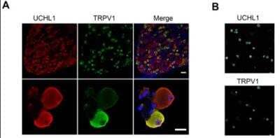 Immunocytochemistry/ Immunofluorescence: UCH-L1/PGP9.5 Antibody [NB110-58872]