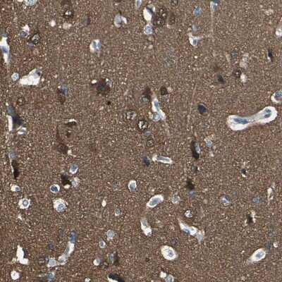 Immunohistochemistry-Paraffin: UCH-L1/PGP9.5 Antibody [NBP1-87334]