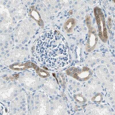 Immunohistochemistry-Paraffin: UCH-L1/PGP9.5 Antibody [NBP1-87334]
