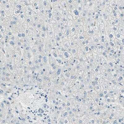 Immunohistochemistry-Paraffin: UCH-L1/PGP9.5 Antibody [NBP1-87334]
