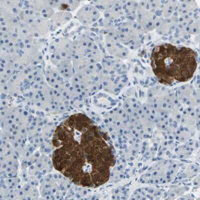 Immunohistochemistry-Paraffin: UCH-L1/PGP9.5 Antibody [NBP1-87334]