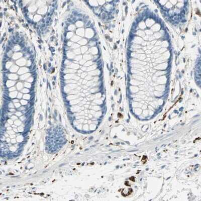 Immunohistochemistry-Paraffin: UCH-L1/PGP9.5 Antibody [NBP1-87334]
