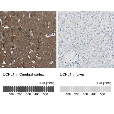 Immunohistochemistry-Paraffin: UCH-L1/PGP9.5 Antibody [NBP1-87334]
