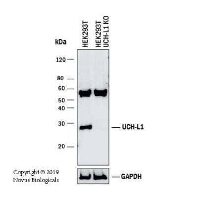 Knockout Validated: UCH-L1/PGP9.5 Antibody [NB300-676]