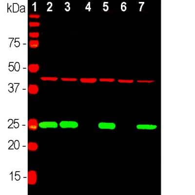 Western Blot: UCH-L1/PGP9.5 Antibody [NB110-58872]