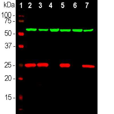 Western Blot: UCH-L1/PGP9.5 Antibody [NB110-58874]