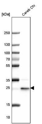 Western Blot: UCH-L1/PGP9.5 Antibody [NBP1-87334]