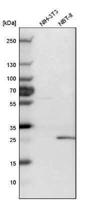 Western Blot: UCH-L1/PGP9.5 Antibody [NBP1-87334]