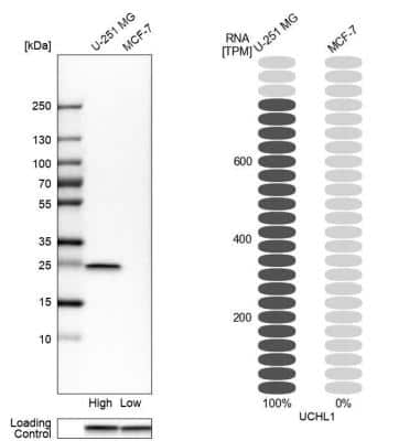 Western Blot: UCH-L1/PGP9.5 Antibody [NBP1-87334]