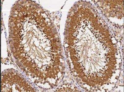 Immunohistochemistry-Paraffin: UCH-L3 Antibody (007) [NBP2-90878]