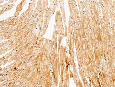 Immunohistochemistry-Paraffin: UCH-L3 Antibody (204) [NBP2-90680]