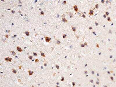 Immunohistochemistry-Paraffin: UCH-L3 Antibody (204) [NBP2-90680]