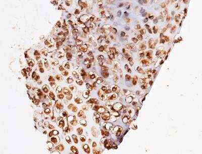 Immunohistochemistry-Paraffin: UCH-L3 Antibody (204) [NBP2-90680]