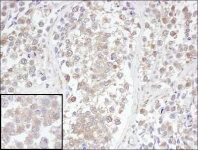 Immunohistochemistry-Paraffin: UCH-L3 Antibody [NBP1-49711]