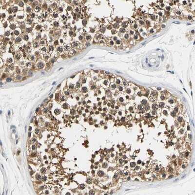 Immunohistochemistry-Paraffin: UCH-L3 Antibody [NBP1-86037]