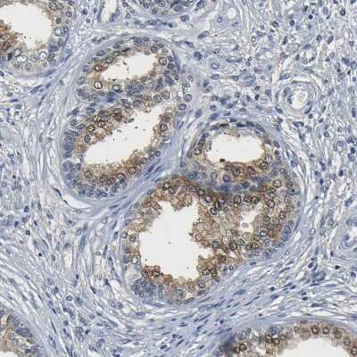 Immunohistochemistry-Paraffin: UCH-L3 Antibody [NBP1-86037]