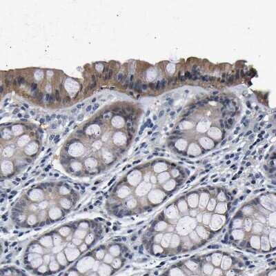 Immunohistochemistry-Paraffin: UCH-L3 Antibody [NBP1-86037]