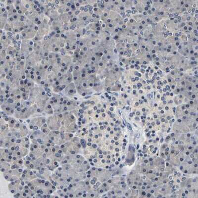 Immunohistochemistry-Paraffin: UCH-L3 Antibody [NBP1-86037]
