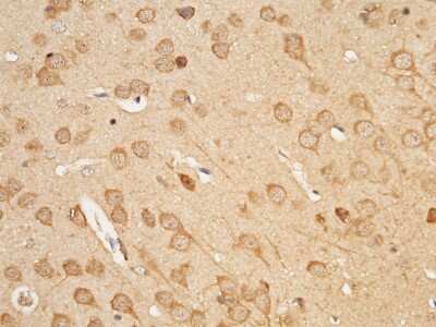 Immunohistochemistry-Paraffin: UCH-L3 Antibody [NBP2-98339]