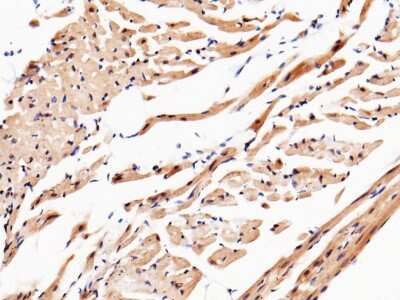 Immunohistochemistry-Paraffin: UCH-L3 Antibody [NBP2-98339]