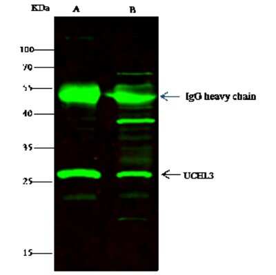 Immunoprecipitation: UCH-L3 Antibody [NBP2-98421]