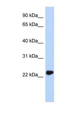 Western Blot: UCH-L3 Antibody [NBP1-55316]