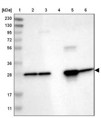 Western Blot: UCH-L3 Antibody [NBP1-86037]