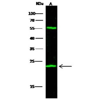 Western Blot: UCH-L3 Antibody [NBP2-98421]