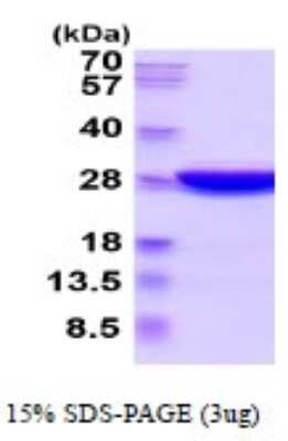 SDS-PAGE: Recombinant Mouse UCH-L3 His Protein [NBP2-52385]