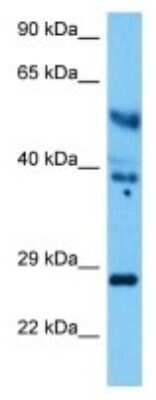 Western Blot: UCH-L4 Antibody [NBP3-10218]