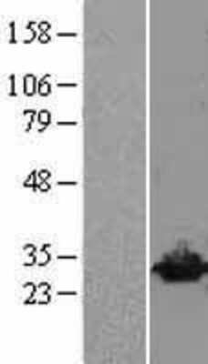 Western Blot: UCH-L3 Overexpression Lysate [NBL1-17576]