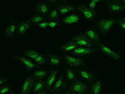 Immunocytochemistry/ Immunofluorescence: UCK Antibody [NBP2-98565]