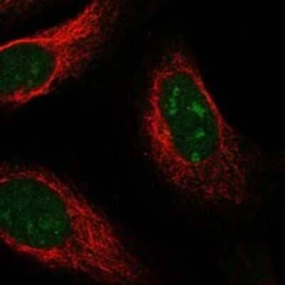 Immunocytochemistry/ Immunofluorescence: UCK Antibody [NBP3-17453]