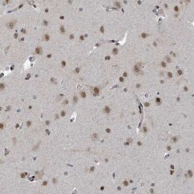 Immunohistochemistry-Paraffin: UCK Antibody [NBP2-47587]