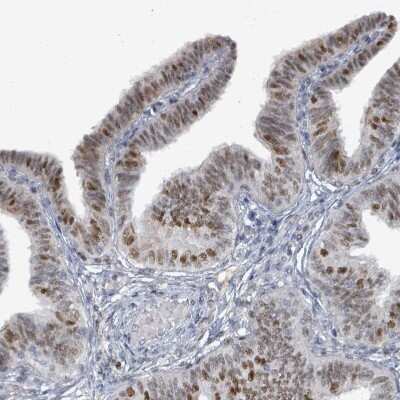 Immunohistochemistry-Paraffin: UCK Antibody [NBP2-47587]