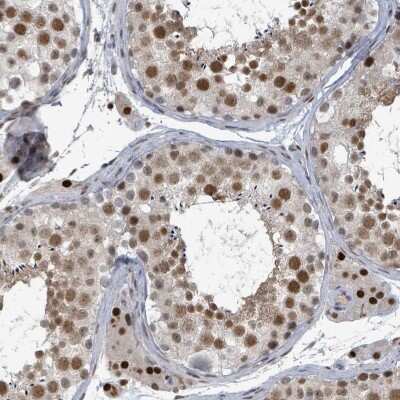 Immunohistochemistry-Paraffin: UCK Antibody [NBP2-47587]