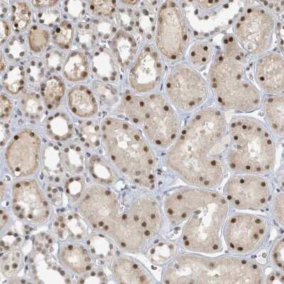 Immunohistochemistry-Paraffin: UCK Antibody [NBP2-47587]