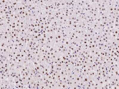 Immunohistochemistry-Paraffin: UCK Antibody [NBP2-98565]