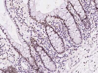 Immunohistochemistry-Paraffin: UCK Antibody [NBP2-98565]