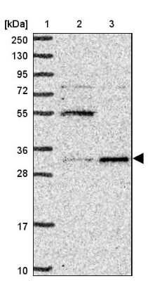 Western Blot: UCK Antibody [NBP2-47587]