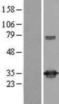 Western Blot: UCK Overexpression Lysate [NBL1-17579]