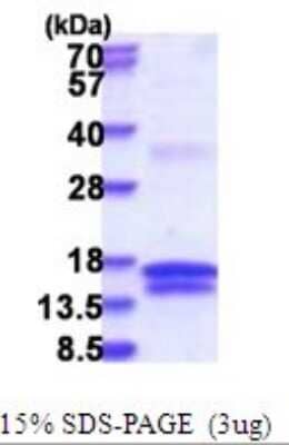 SDS-PAGE: Recombinant Human UCK His Protein [NBP2-51705]