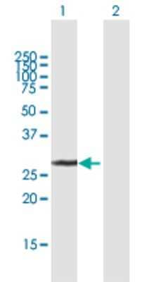 Western Blot: UCK2 Antibody [H00007371-B01P]