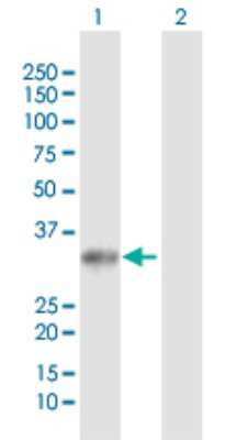 Western Blot: UCK2 Antibody [H00007371-D01P]