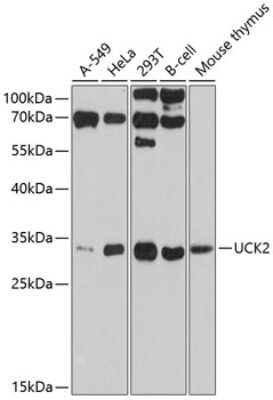 Western Blot: UCK2 AntibodyAzide and BSA Free [NBP2-94297]