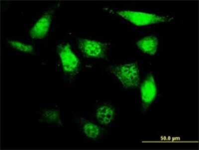 Immunocytochemistry/ Immunofluorescence: UCKL1 Antibody (8D4) [H00054963-M01]