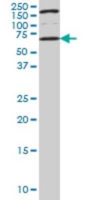 Western Blot: UCKL1 Antibody (8D4) [H00054963-M01]