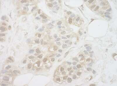 Immunohistochemistry-Paraffin: UCKL1 Antibody [NBP1-42680]